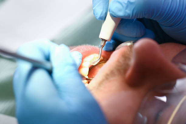 Best Dentist for Tooth Abscess  in Midway, NC